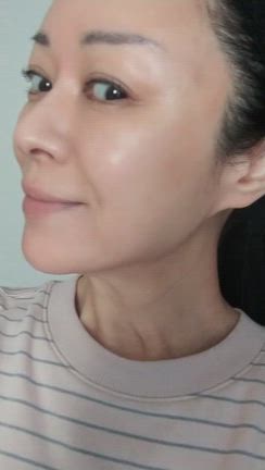 水光注射のダウンタイム５日目の朝の動画の記事動画