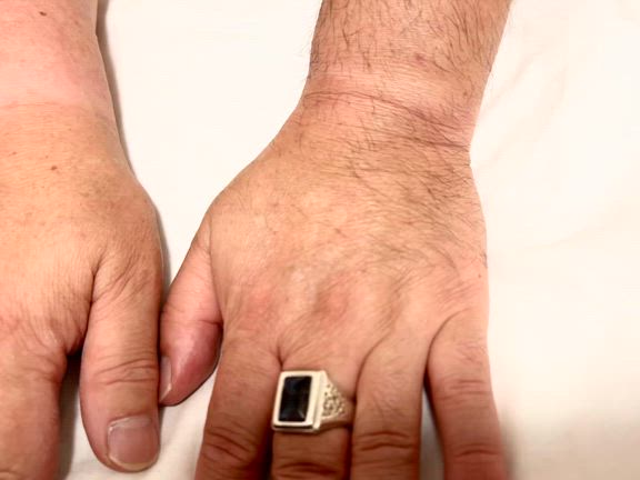 暑い季節はシュガーリングが人気ですの記事動画