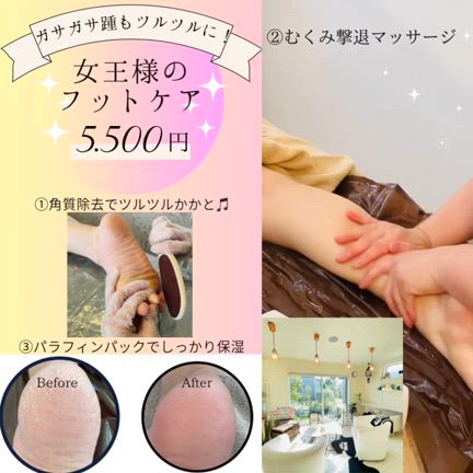 そのかかと大丈夫ですかー？の記事動画