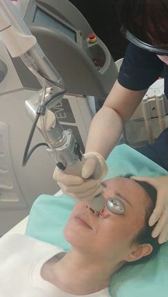 ルビーフラクショナルレーザーはすごかった！の記事動画