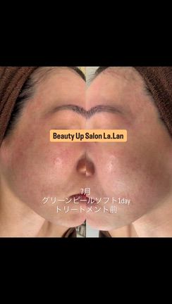 効果をご実感いただけなければ全額返金いたしますの記事動画