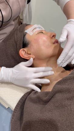 美容皮膚科でコンプレックスを解消！@ピュアビューティー恵比寿の記事動画