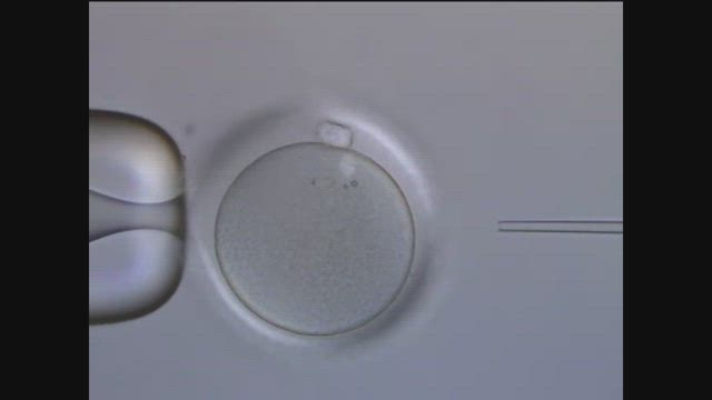 顕微授精をもっと詳しく〜 顕微授精の基本を知る 〜の記事動画
