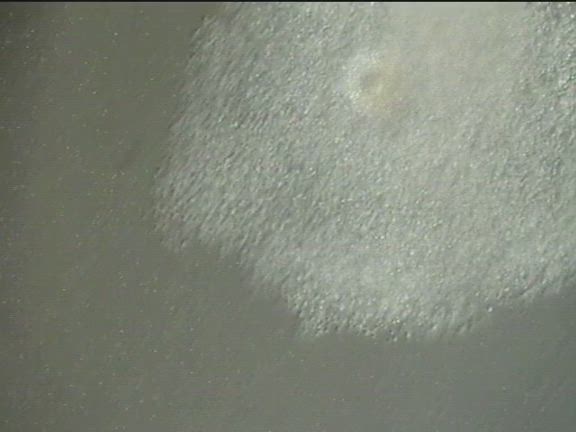 体外受精についての記事動画