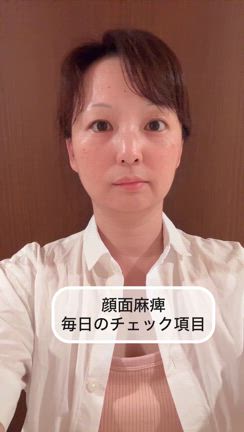 顔面神経麻痺の動画の記事動画