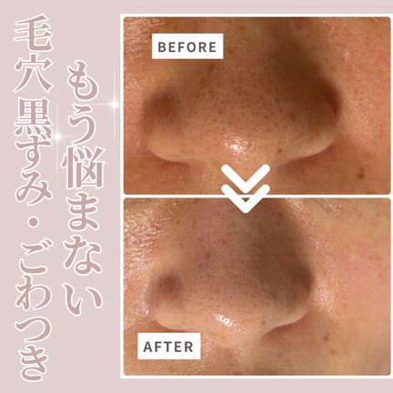 お顔がトーンupの記事動画