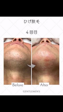 たまってしまった写真をまとめてUPしてみた！の記事動画