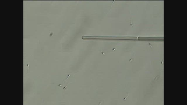 顕微授精をもっと詳しく〜 顕微授精の基本を知る 〜の記事動画