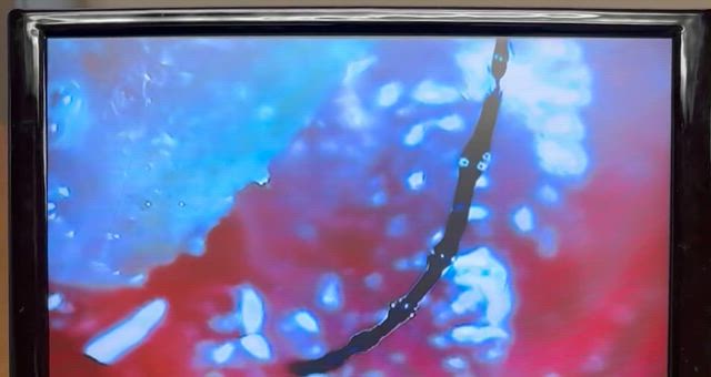 札幌1人目の破壊の記事動画