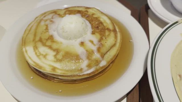 ひどい顎なしと口ゴボ、下顎矮小症　してはいけない治療・手術④－セットバック　ASOの記事動画