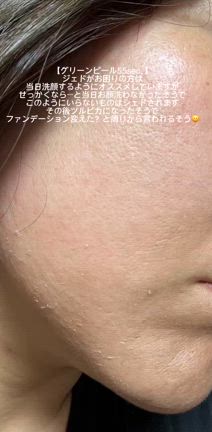 美容院感覚！グリーンピール55secの記事動画