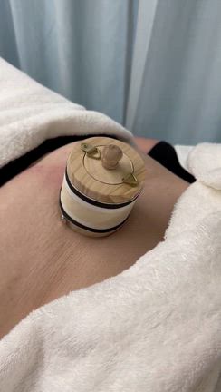 兵庫県高砂市のKOBA鍼灸院ではお灸がいっぱい体験できますの記事動画