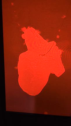 ｉＰＳ心臓展の記事動画