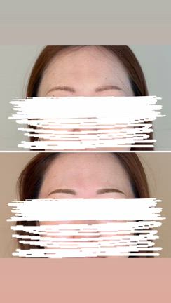 アートメイクから1年後とリタッチの記事動画