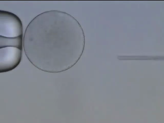 透明帯がない卵子へのアプローチ～顕微授精の動画と胚発育の動画から～の記事動画