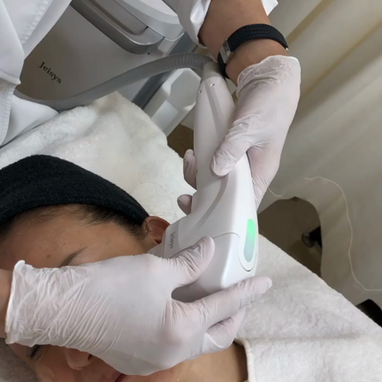 HIFU （ハイフ）によるたるみ治療の動画撮影しましたの記事動画