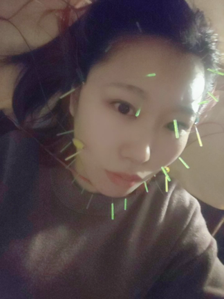 【ほんとに凄い】美容鍼初体験レポ《2327》の記事動画