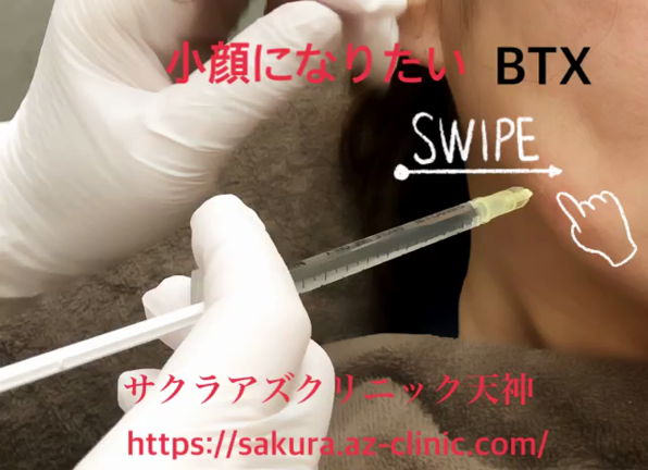 クリスマスまでに小顔になりたい。の記事動画