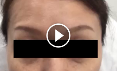 力強い眉間のしわの記事動画