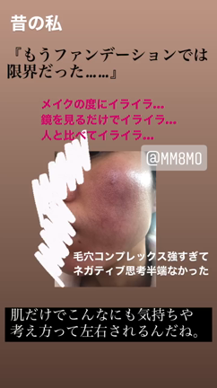 毛穴がある人は人からどう思われてるか気になる？の記事動画