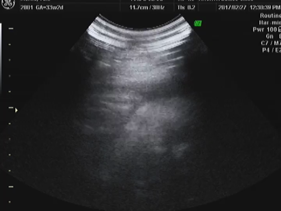 【妊婦徒然日記】33w2d  エコーでまばたきパチパチ♡の記事動画