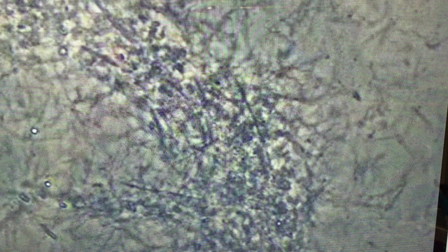 お口の中の菌をみてみませんか？の記事動画