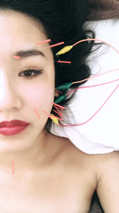 初めての鍼灸治療★の記事動画