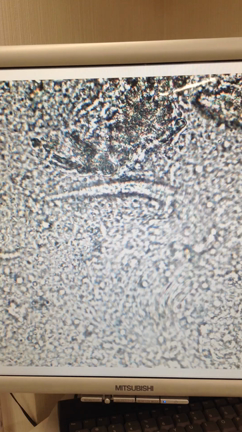 本日の寄生虫の記事動画