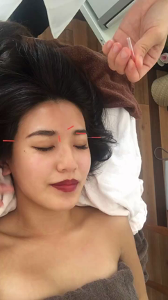 初めての鍼灸治療★の記事動画