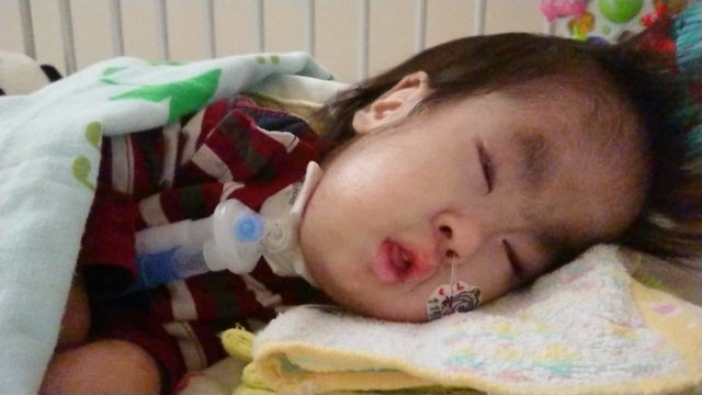 生後1151日目・入院３日目の記事動画