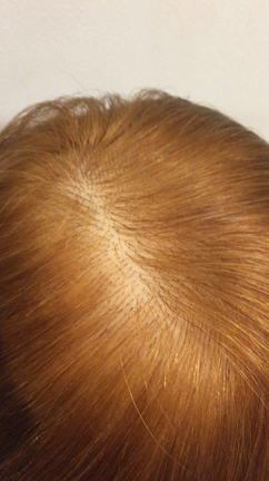 その日だけ白髪隠し☆の記事動画