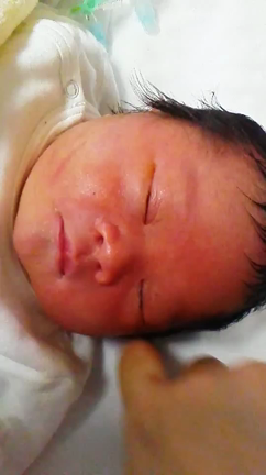 新生児低血糖 米田家日記