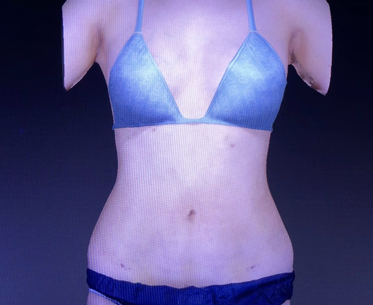 欲張りなナース、、、、7日目の抜糸です。動画の記事動画