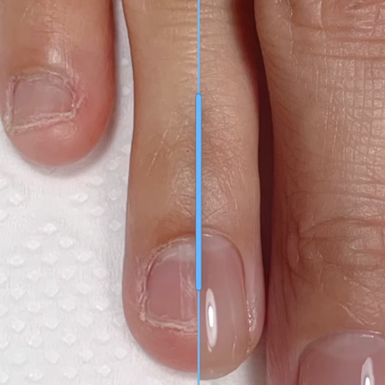 深爪について /  深爪育成経過の記事動画