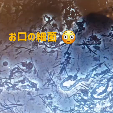 歯周病の方や歯ぐきが気になる方はコレ‼︎の記事動画