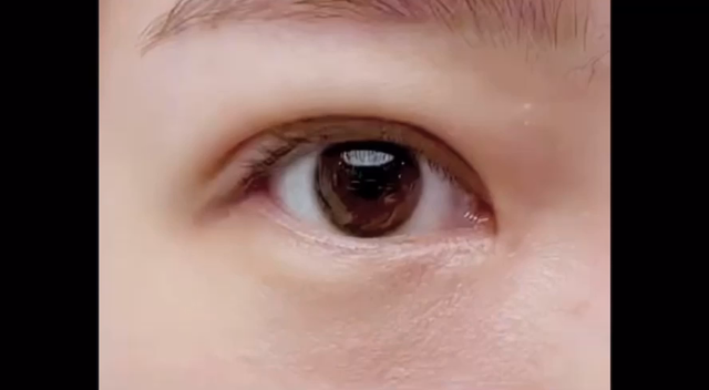 【韓国SM美容外科】完全一重、眠そうな目つき、自然癒着で傷痕なく解決！✍作成者イ·ムヨン代表院長の記事動画