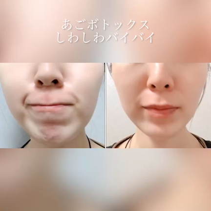 ～スタッフのアゴ事情～の記事動画