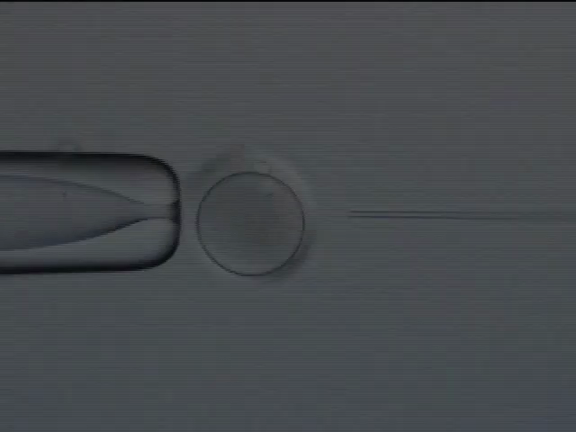 当院の顕微授精の特徴の記事動画