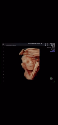 4dエコー！！！の記事動画