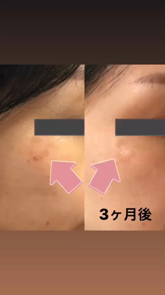 たったの３ヶ月で、、、の記事動画