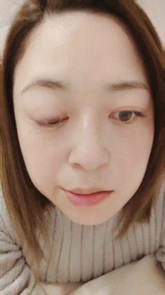 気怠い感じはマシになってきた、と。顔面記録の記事動画