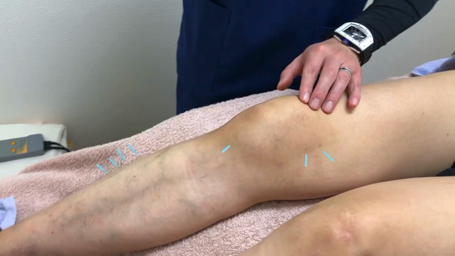 バレエダンサーの膝痛治療の記事動画