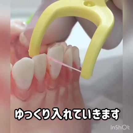 歯磨きの仕上げに‼︎デンタルフロス✨の記事動画