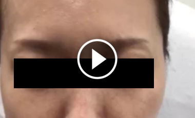 力強い眉間のしわの記事動画