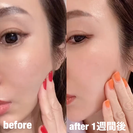 エラボトックス❤️の記事動画