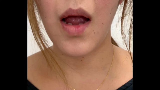 顎 関節症。→  アハハwの記事動画