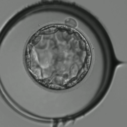 どうしてアシステッドハッチングは必要？の記事動画