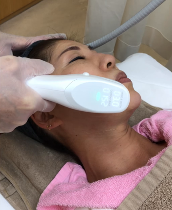 20%増のハイフ治療　ウルトラセルZi（ズィー）始まりました！の記事動画