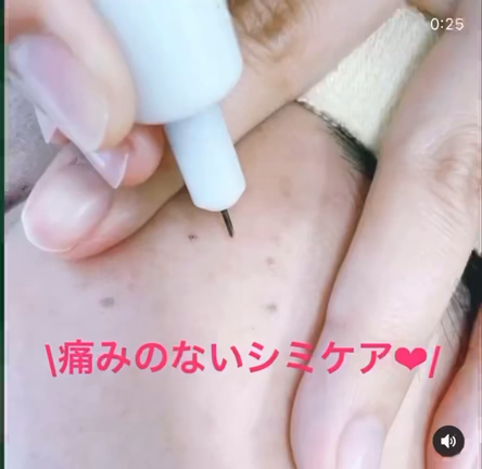 シミケア美肌専門サロン★Salon de H★低周波シミケア★シミ取り★シミ取り放題★シミケアの記事動画
