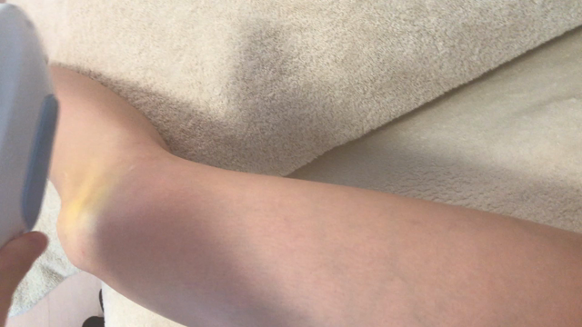 IPL脱毛＋SHR脱毛で、早くキレイ。 江戸川区 平井 脱毛サロンの記事動画